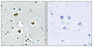 Immunohistochemical analysis of paraffin-embedded human brain tissue using Anti-HMG17 Antibody The right hand panel represents a negative control, where the antibody was pre-incubated with the immunising peptide