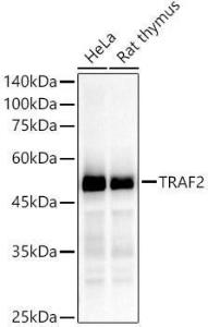 Western blot analysis of various lysates, using Anti-TRAF2 Antibody [ARC51292] (A305567) at 1:50,000 dilution. The secondary Antibody was Goat Anti-Rabbit IgG H&L Antibody (HRP) at 1:10000 dilution.