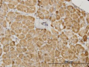 Anti-PDK2 Mouse Monoclonal Antibody [clone: 5F8]