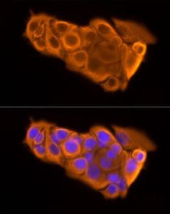 Immunofluorescence analysis of MCF7 cells using Anti-Cytokeratin 19 Antibody [ARC2811] (A307943) at a dilution of 1:20 (40x lens) DAPI was used to stain the cell nuclei (blue)