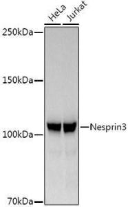 Western blot analysis of extracts of various cell lines, using Anti-Nesprin3 Antibody [ARC3013] (A309420) at 1:1,000 dilution