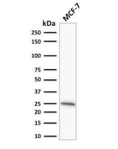 Western blot analysis of human MCF-7 cell lysate using Anti-Bcl-2 Antibody [SPM530]