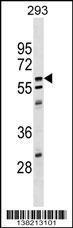 Anti-CPNE5 Rabbit Polyclonal Antibody (APC (Allophycocyanin))