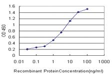 Anti-PDK2 Mouse Monoclonal Antibody [clone: 5F8]