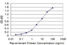 Anti-BARX1 Mouse Monoclonal Antibody [clone: 1E7]