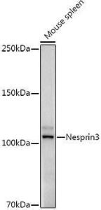 Western blot analysis of extracts of Mouse spleen, using Anti-Nesprin3 Antibody [ARC3013] (A309420) at 1:1,000 dilution