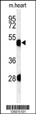 Anti-KRT82 Rabbit Polyclonal Antibody