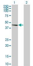 Anti-PDK2 Mouse Monoclonal Antibody [clone: 2D12]