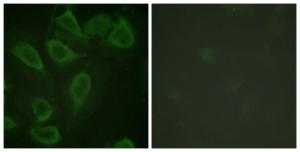 Immunofluorescence analysis of HeLa cells using Anti-PECAM-1 (phospho Tyr713) Antibody. The right hand panel represents a negative control, where the Antibody was pre-incubated with the immunising peptide