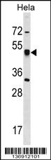 Anti-CRTAP Rabbit Polyclonal Antibody