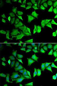 Immunofluorescence analysis of MCF-7 cells using Anti-RPS12 Antibody (A11894). DAPI was used to stain the cell nuclei (blue)