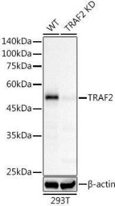 Western blot analysis of extracts from wild type(WT) and TRAF2 knockdown (KD) 293T cells, using Anti-TRAF2 Antibody [ARC51292] (A305567) at 1:50,000 dilution. The secondary Antibody was Goat Anti-Rabbit IgG H&L Antibody (HRP) at 1:10000 dilution