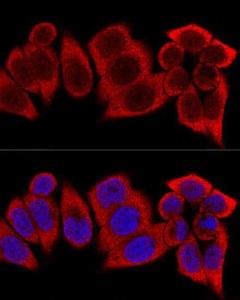 Confocal immunofluorescence analysis of HeLa cells using Anti-RPS12 Antibody (A11894) at a dilution of 1:400. DAPI was used to stain the cell nuclei (blue)