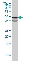 Anti-PDK3 Mouse Monoclonal Antibody [clone: 2B11]