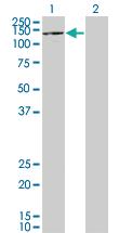 Anti-AGTPBP1 Mouse Polyclonal Antibody