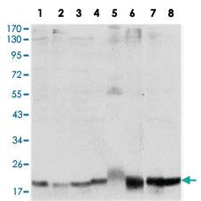 Anti-SKP1 Mouse Monoclonal Antibody [clone: 4E11]