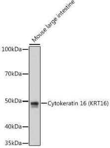 Western blot analysis of extracts of Mouse large intestine cells, using Anti-Cytokeratin 16/K16 Antibody [ARC1783] (A307945) at 1:1,000 dilution