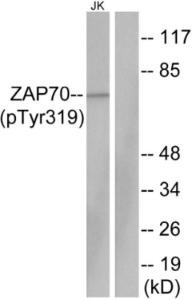 Western blot analysis of lysates from Jurkat cells using Anti-ZAP-70 (phospho Tyr319) Antibody. The right hand lane represents a negative control, where the antibody is blocked by the immunising peptide