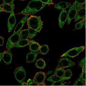 Immunofluorescent analysis of PFA-fixed HeLa cells stained with Anti-PRMT7 Antibody [PCRP-PRMT7-1A7] followed by Goat Anti-Mouse IgG (CF&#174; 488) (Green). CF&#174; 640R Phalloidin (Red).