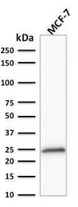 Western blot analysis of MCF-7 cell lysate using Anti-Bcl-2 Antibody [100/D5+124]