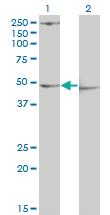 Anti-PDK3 Mouse Monoclonal Antibody [clone: 2B11]