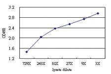 Anti-CA12 Antibody Pair