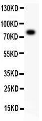 Anti-ALOX5/5 Lo Polyclonal Antibody