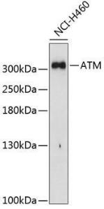 Western blot analysis of extracts of H460 cells, using Anti-ATM Antibody (A11896) at 1:1,000 dilution. The secondary antibody was Goat Anti-Rabbit IgG H&L Antibody (HRP) at 1:10,000 dilution.