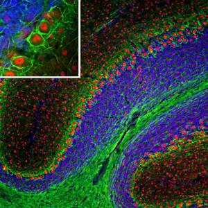 Immunofluorescent analysis of a section of mouse cerebellum stained with Anti-NF-L Antibody [7D1] (A85453), at a dilution of 1:5,000 in green, and co-stained with Anti-FOX2 Antibody (A104328), at a dilution of 1:2,000 in red