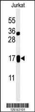 Anti-LIMD2 Rabbit Polyclonal Antibody