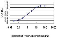 Anti-PDK3 Mouse Monoclonal Antibody [clone: 2B11]