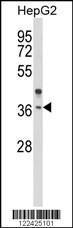 Anti-OR2H2 Rabbit Polyclonal Antibody (Biotin)