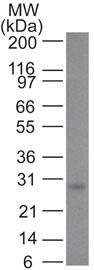 Western blot analysis of human skin tissue lysate using Anti-Bcl-2 Antibody [100/D5+124]