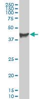 Anti-PDK3 Mouse Monoclonal Antibody [clone: 3A1]