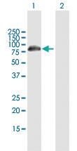 Anti-DCP1B Mouse Polyclonal Antibody