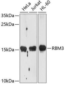 Western blot analysis of extracts of various cell lines, using Anti-RBM3 Antibody (A11899) at 1:1000 dilution. The secondary Antibody was Goat Anti-Rabbit IgG H&L Antibody (HRP) at 1:10000 dilution. Lysates/proteins were present at 25 µg per lane