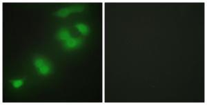 Immunofluorescence analysis of HepG2 cells using Anti-CREBZF Antibody. The right hand panel represents a negative control, where the antibody was pre-incubated with the immunising peptide.