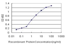 Anti-PDK3 Mouse Monoclonal Antibody [clone: 3A1]