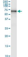 Anti-STS Polyclonal Antibody Pair