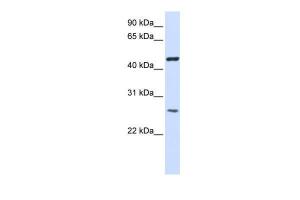 Anti-TMEM127 Rabbit Polyclonal Antibody