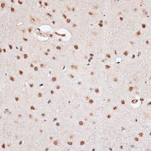 Immunohistochemistry analysis of paraffin-embedded rat brain using Anti-RBM3 Antibody (A11899) at a dilution of 1:100 (40X lens). Perform microwave antigen retrieval with 10 mM PBS buffer pH 7.2 before commencing with IHC staining protocol