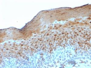 Immunohistochemical analysis of formalin-fixed, paraffin-embedded human tonsil using Anti-Involucrin Antibody [SY5]