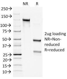 SDS-PAGE analysis of Anti-Bcl-2 Antibody [100/D5+124] under non-reduced and reduced conditions; showing intact IgG and intact heavy and light chains, respectively. SDS-PAGE analysis confirms the integrity and purity of the antibody