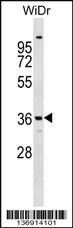 Anti-ANXA9 Rabbit Polyclonal Antibody