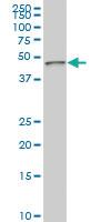 Anti-PDK3 Mouse Monoclonal Antibody [clone: 1G11]