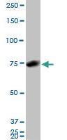 Anti-HNRNPM Mouse Monoclonal Antibody [clone: 3F7]