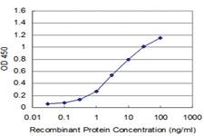 Anti-PDK3 Mouse Monoclonal Antibody [clone: 1G11]