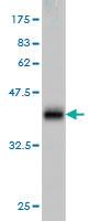 Anti-B4GALT4 Mouse Monoclonal Antibody [clone: 5E2]