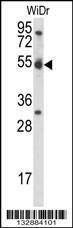 Anti-CCNI Rabbit Polyclonal Antibody (HRP (Horseradish Peroxidase))