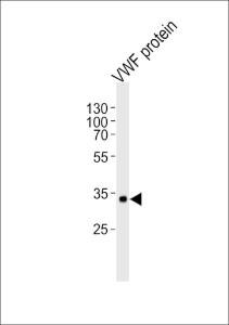 Anti-VWF Mouse Monoclonal Antibody [clone: 907CT12.1.9]